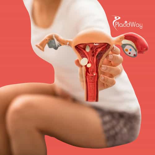 Cáncer de ovario en México: el papel de las inmunoterapias y enfoques alternativos